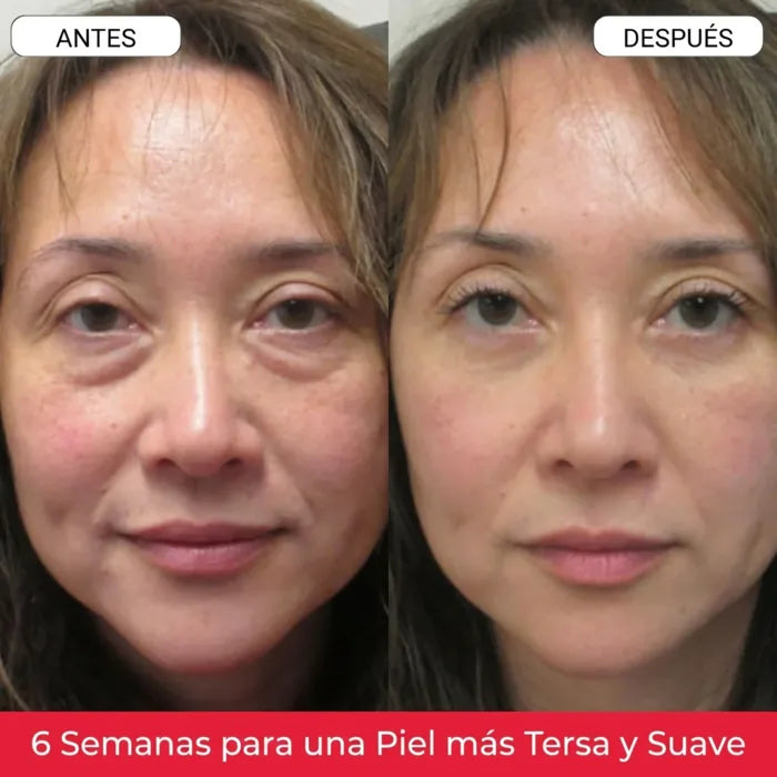 1. Elimina los ojos cansados en semanas