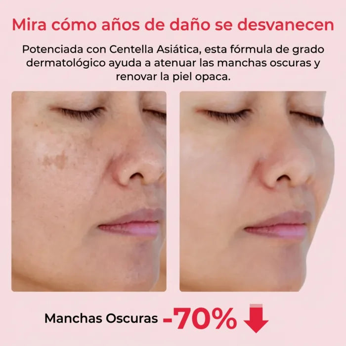 4. Desvanece paño, manchas y cicatrices viejas